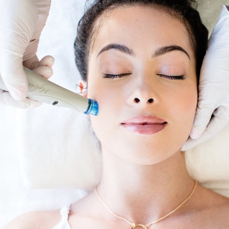 Hydrafacial